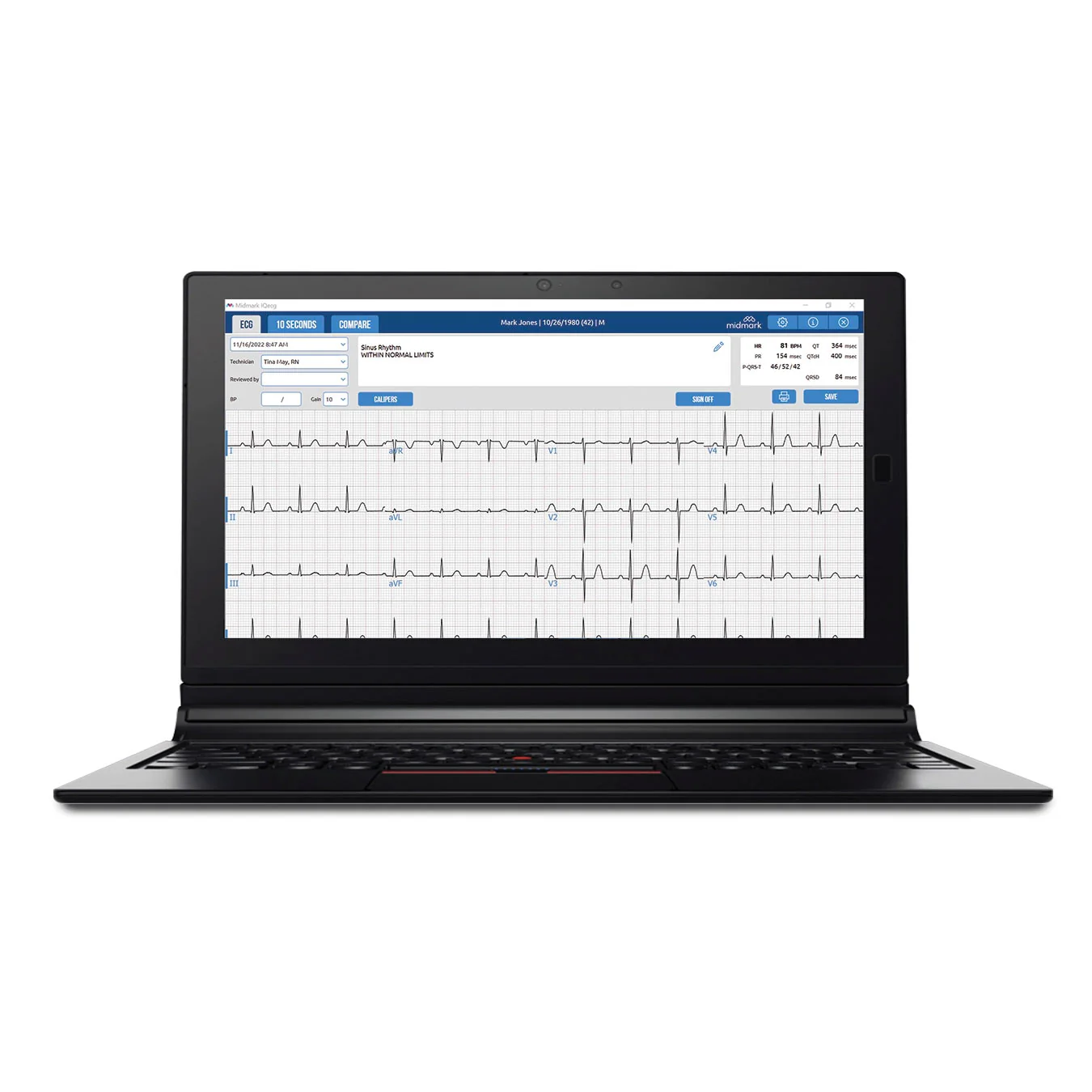 Midmark Digital IQ ECG With Lead Management - Image 3